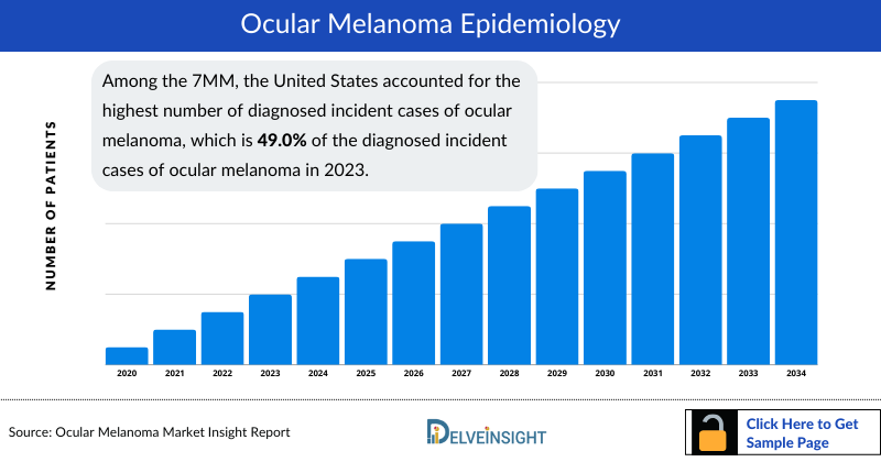 Ocular Melanoma Epidemiology